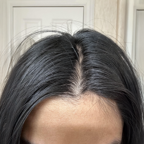 Before Image