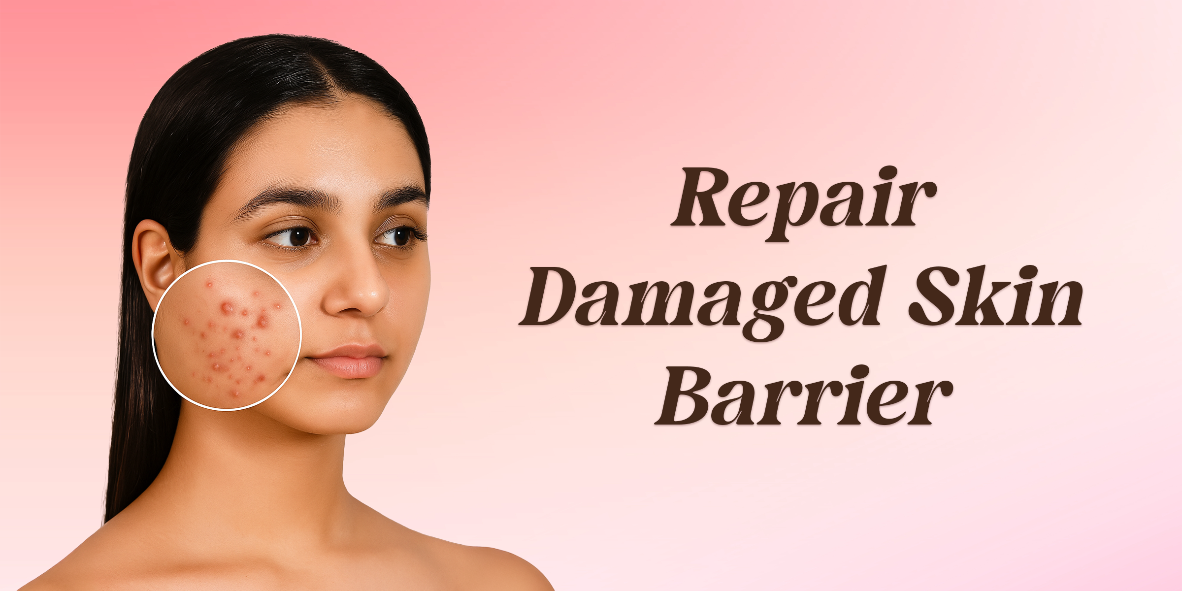 How To Repair Your Damaged Skin Barrier?